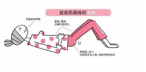 女性宫颈下垂锻炼法图详解