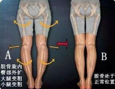 锻炼方法里骨盆怎么锻炼的？