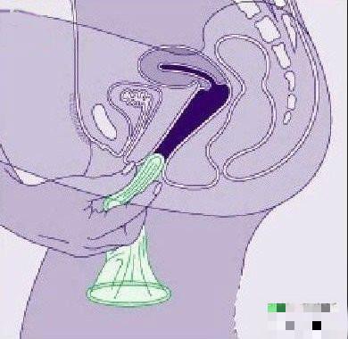 360度演示女用避孕套使用方法（全图）4