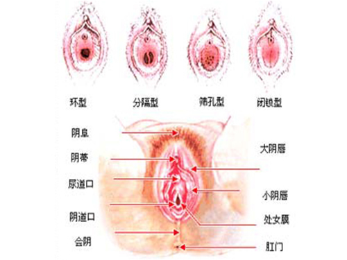 高清全图：美女处女膜的结构1