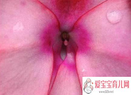 详解女性阴蒂阴道口的位置(高清图)13