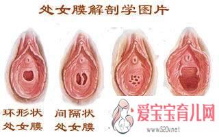 详解女性阴蒂阴道口的位置(高清图)11