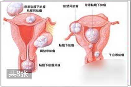 多图详解:女人私穴深处长啥样4