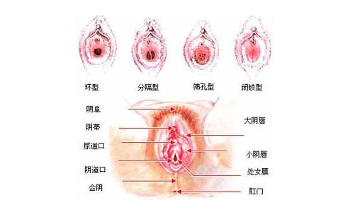 多图实拍：处女膜的位置及各种形态