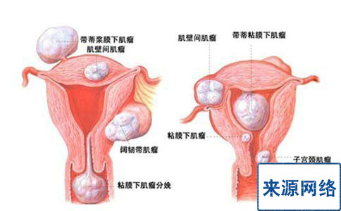 青春期少女如何呵护自己的卵巢